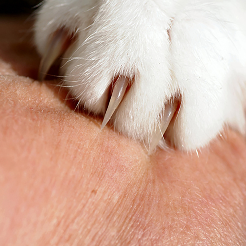 【猫ひっかき病】噛まれた・ひっかき傷ができた場合は要注意！人獣共通感染症について